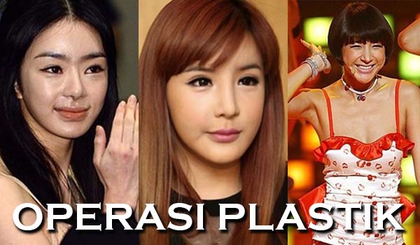 Aneh! 5 Wajah Artis Korea Ini Berubah Jadi Aneh Setelah Operasi Plastik