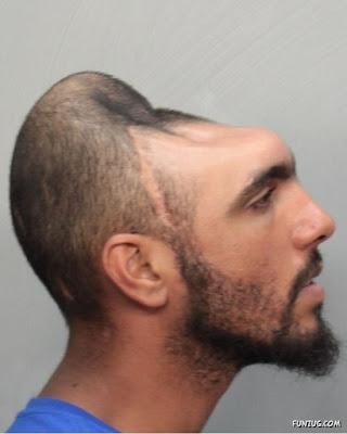 Man With Half Head