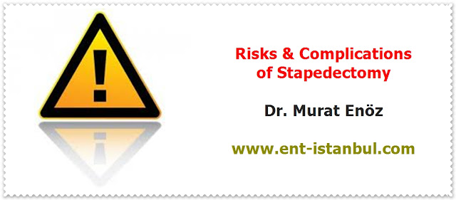 Stapedectomy Operation - Total Stapedectomy - Partial Stapedectomy - Stapedotomy - Stapedial Ankylosis - Preoperative Diagnostic Procedures For Stapedectomy - Indications For Stapedectomy Operation - Contrandications For Stapedectomy Operation - Stapedectomy Technique - Stapedectomy by using Titanium Piston - Stapedectomy Risks & Complications - Postoperative Patient Care For Stapedectomy