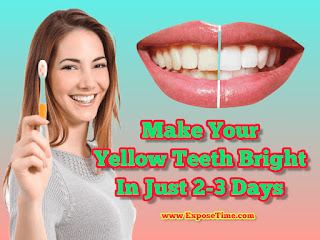 make-your-yellow-teeth-bright-in-just-2-3-days