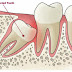 Phân tích mọc răng khôn có ảnh hưởng gì không từ nha sĩ