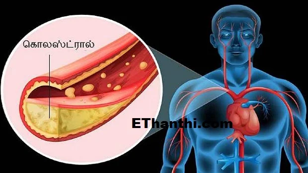 இந்த தவறு தான் கொலஸ்ட்ரால் அளவை அதிகரிக்கிறது? 
