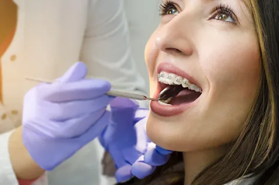 Orthodontist Service in Melbourne