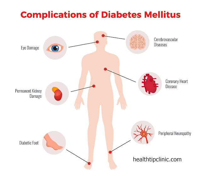 blood glucose level