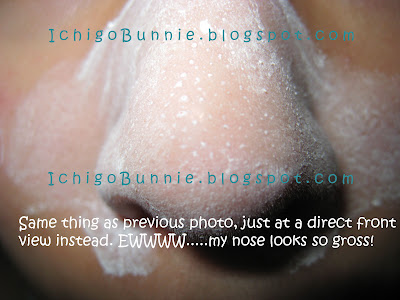 clogged pores on nose. clogged pores on nose