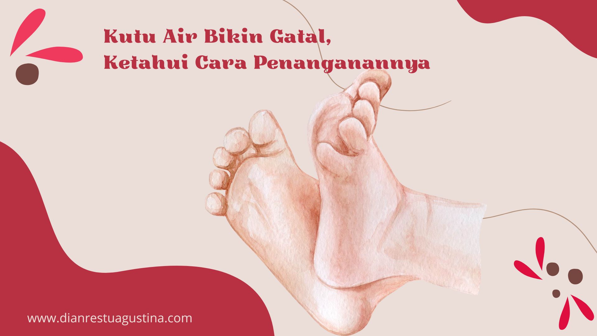 Kutu Air Bikin Gatal, Ketahui Cara Penanganannya