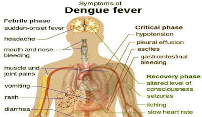 Dengue