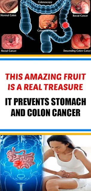 This Amazing Fruit is a Real Treasure. It Prevents Stomach And Colon Cancer