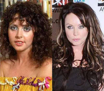 Sarah Brightman Liposuction Surgery