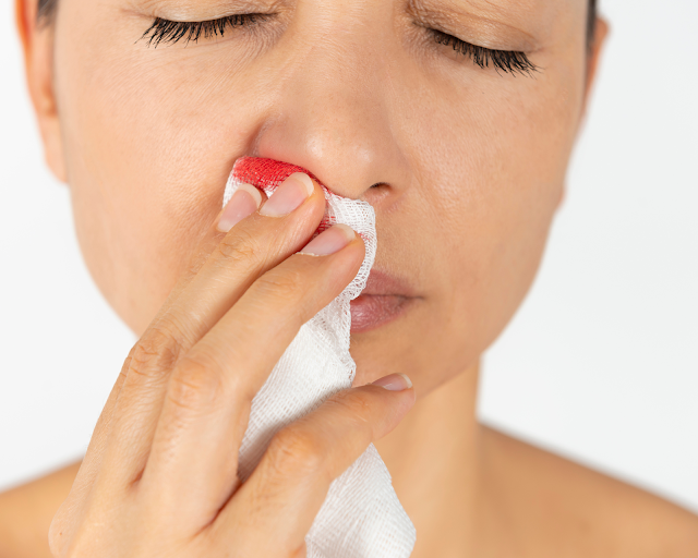 Pourquoi un saignement du nez peut-être bon pour vous ?