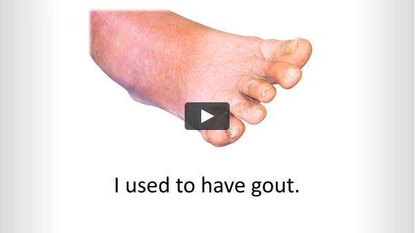  Any treatment is comprehensive for gout