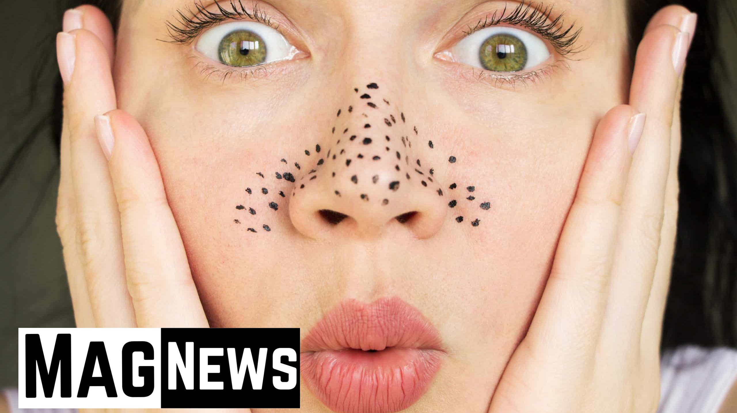liminate blackheads and remove them completely