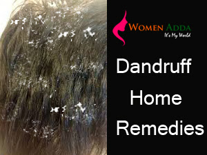 Dandruff -Home remedies