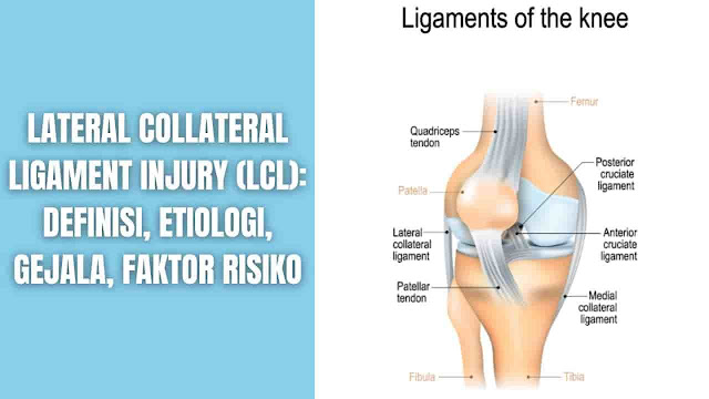 Lateral Collateral Ligament Injury (LCL): Definisi, Etiologi, Gejala, Faktor Risiko Definisi Lateral Collateral Ligament (LCL) juga dikenal sebagai ligamen fibula, memiliki fungsi sebagai salah satu penstabil sendi lutut. Berorigo dari epikondilus lateral femur dan berinsersi di kepala fibula, tujuan utama dari LCL adalah untuk mencegah stres varus yang berlebihan dan rotasi posterior-lateral lutut. Walaupun cedera lutut yang paling jarang terjadi, kecurigaan yang tinggi diperlukan untuk cedera LCL dan cedera sudut posterior-lateral (PLC) pada semua pemeriksaan lutut.    Etiologi Secara etiologi, mekanisme cedera yang paling umum dari cedera LCL terlihat melalui pukulan energi tinggi ke lutut anteromedial, menggabungkan hiperekstensi dan kekuatan varus yang ekstrem. Hiperekstensi nonkontak dan stresor varus nonkontak juga telah dilaporkan menyebabkan cedera LCL.    Gejala Individu yang mengalami cedera LCL akan mengalami gejala seperti:  Nyeri mendadak di bagian luar (lateral) lutut Kekakuan dan kesulitan menggerakkan lutut Pembengkakan dan nyeri tekan di bagian luar (lateral) lutut Memar Merasa bahwa lutut tidak stabil, mungkin terkunci, atau akan mnyerah pada saat meletakkan beban di atasnya    Faktor Risiko Setiap individu dapat terkena cedera LCL, partisipasi dalam olahraga tertentu menempatkan orang pada risiko yang lebih tinggi. Individu yang sering melakukan olahraga kontak dan non-kontak yang melibatkan tackling, cutting, picoting, dan jumping lebih mungkin mengalami cedera LCL. Olahraga ini termasuk namu tidak terbatas pada sepak bola, hoki, soccer, dan ski.