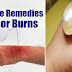 Simple Home Remedies For Minor Burns