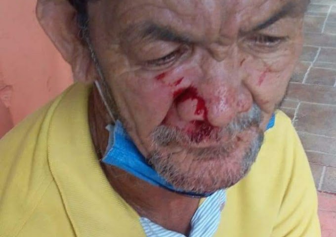 Venezolano le habría causado lesiones a adulto mayor con discapacidad en Sincelejo