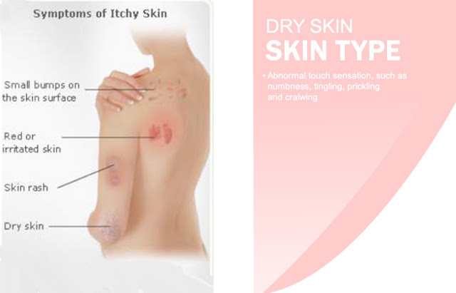 Dry Skin Type