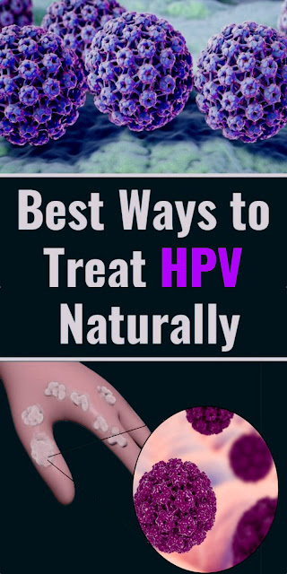 Best Ways To Treat HPV Naturally