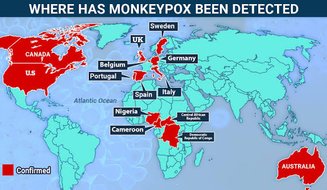 What countries have monkeypox 2022?,Are monkey pox cases declining?,How many deaths has monkeypox caused?,How many cases of monkeypox in UK now?,Monkeypox outbreak 2022,Monkeypox cases by country,Interesting facts about monkeypox,Symptoms of monkeypox,Monkeypox cure,Monkeypox lockdown