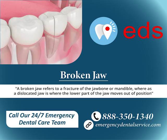 Broken Jaw Treatment - Emergency Dental Service