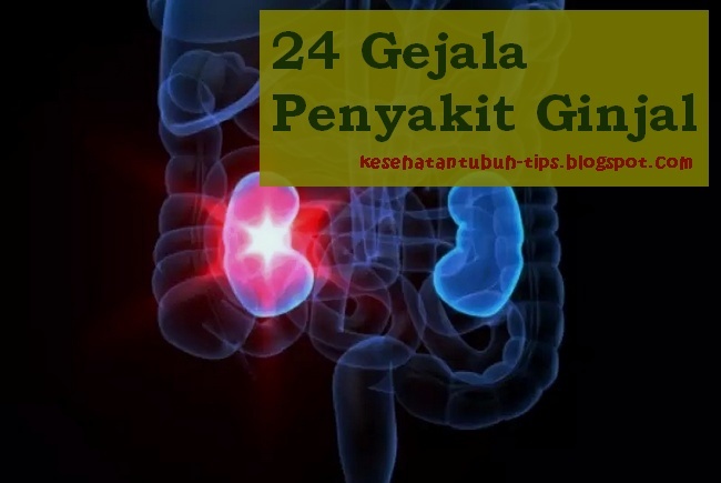24 Gejala Penyakit Ginjal: Sering Kram, Gatal, Nyeri dll