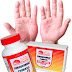 Psoriasis Tablets