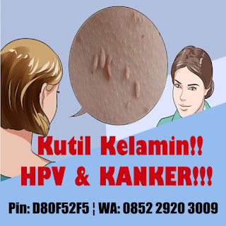 Obat Kutil Kelamin