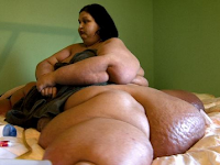 A incrível mudança de uma mulher de 400kg