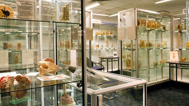 Museum Kedokteran Paling Menyeramkan Di Dunia