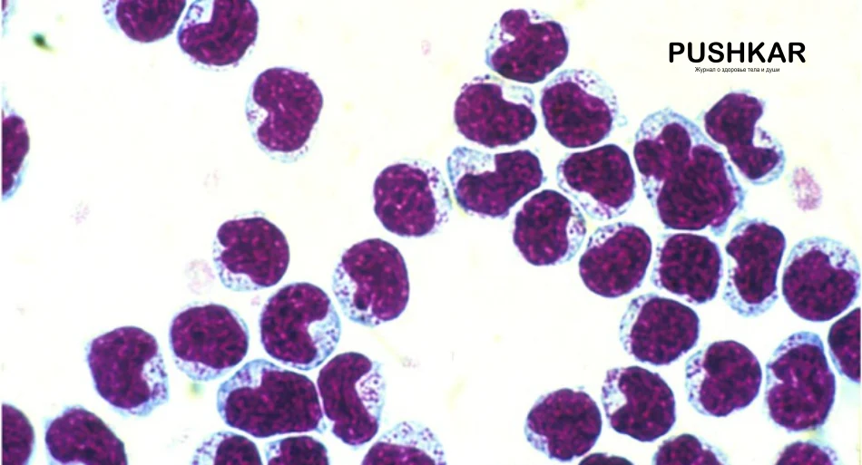 Природные клетки-киллеры (NK-клетки), отделенные от периферической крови крыс F344 на градиенте Перколла.