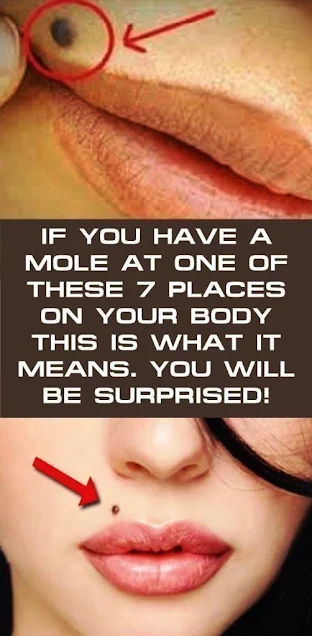 If You Have A Mole At One Of These 7 Places On Your Body This Is What It Means. You Will Be Surprised!