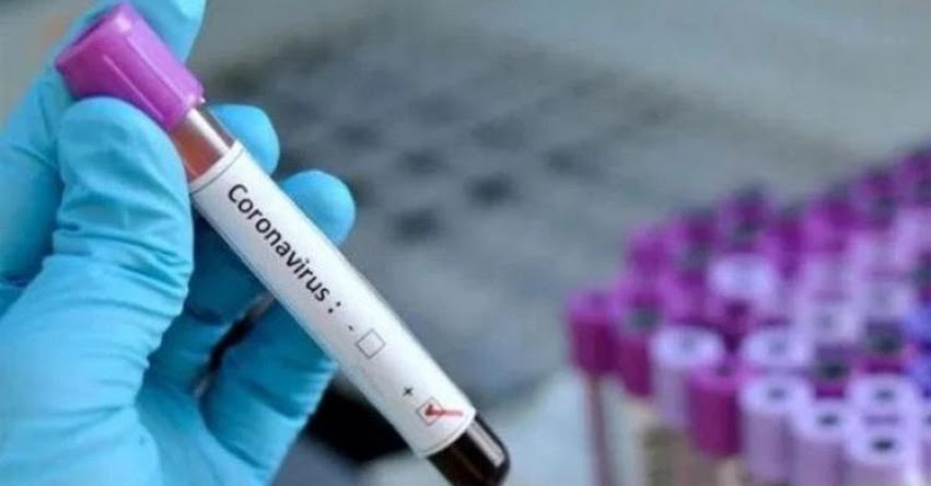 CORONAVIRUS EN PERÚ: Aumentan a 10 los casos confirmados en La Libertad