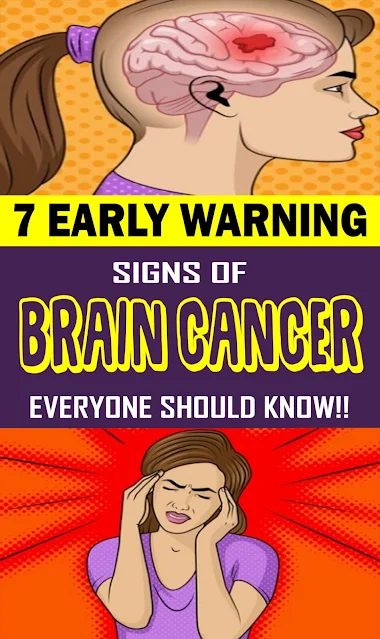 7 warning signs of a brain tumor