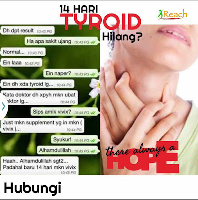 Punca Penyakit Hyperthyroid Dan Rawatan Tanpa Pembedahan 