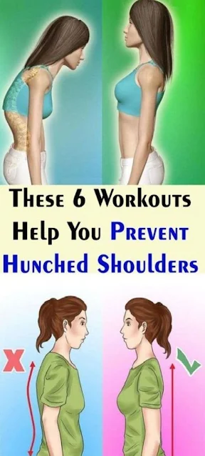 Simple Exercises to Improve Posture and Prevent Hunched Shoulders