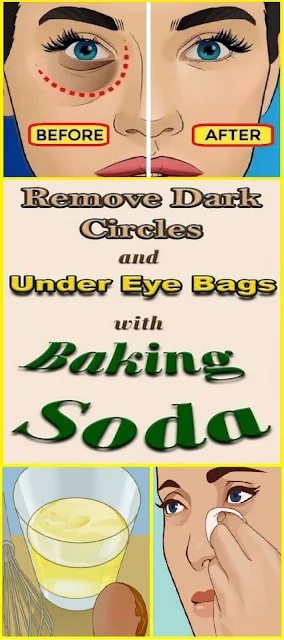 Remove Dark Circles & Under Eye Bags with Baking Soda & Lemon