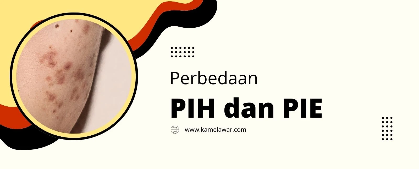Perbedaan antara PIH dan PIE