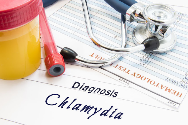 Get Screened For Chlamydia