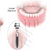 Ưu điểm của Mini Implant