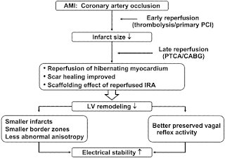 acute myocardial infarction pronosis