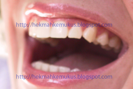 Tips Menjaga Kebersihan Mulut dan Gigi