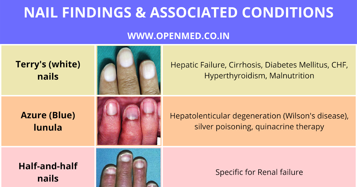 PDF) Nail disorders and systemic disease: What the nails tell us