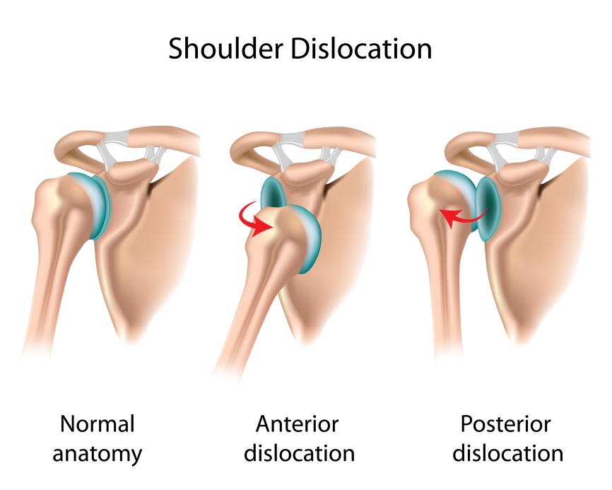 Exercises For Torn Shoulder Ligaments : Items You Must Know About Fat Burning Foods Ahead Of You Lose Weight