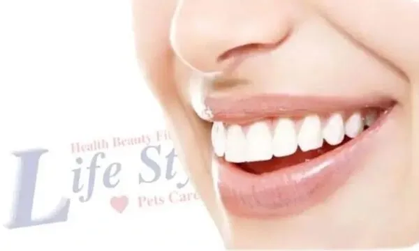 Teeth. Best Treatment for Whitening Teeth, Natural Teeth Whitening