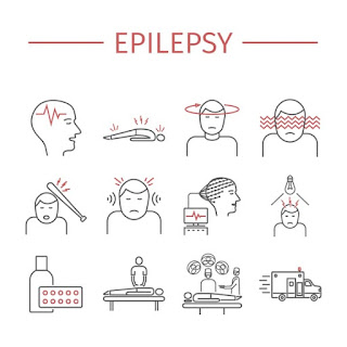 Inilah Cara Untuk Mengobati Epilepsi Secara Efektif Tuntaskan Penyakit Sampai Sembuh