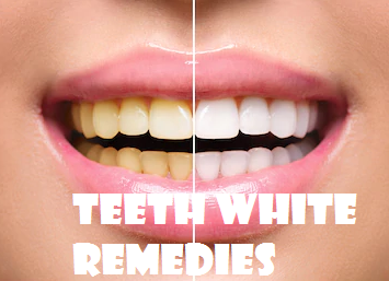 Teeth Whitening Home Remedies 