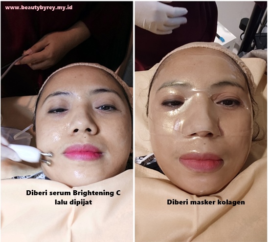 Treatment Korean Bright Toning Di Ella Skin Care Sidoarjo
