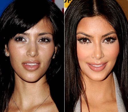 kim kardashian plastic surgery before. Kim Kardashian quot;Beforequot; and