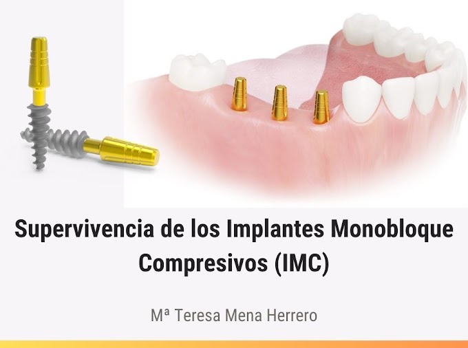 PDF: Supervivencia de los implantes monobloque compresivos