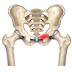 INFLAMMATION OF THE BONES (Osteitis)